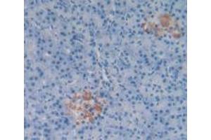 Detection of SP in Human Pancreas Tissue using Polyclonal Antibody to Substance P (SP) (Substance P 抗体)