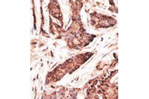Image no. 2 for anti-2'-5'-Oligoadenylate Synthetase-Like (OASL) (C-Term) antibody (ABIN358720) (OASL 抗体  (C-Term))