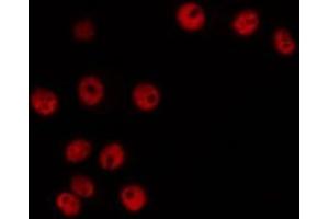 ABIN6266480 staining HeLa by IF/ICC. (Cyclin H 抗体  (C-Term))