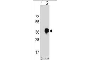 Western blot analysis of MLX (arrow) using rabbit polyclonal MLX Antibody (Center) (ABIN652578 and ABIN2842390). (MLX 抗体  (AA 125-151))