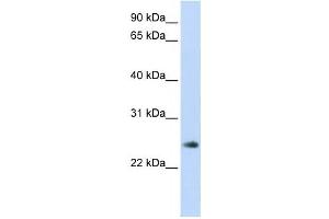 Western Blotting (WB) image for anti-Thymocyte Nuclear Protein 1 (THYN1) antibody (ABIN2459839) (THYN1 抗体)