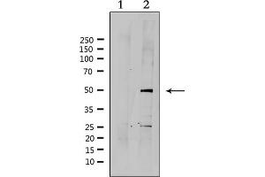 Western blot analysis of extracts from HepG2, using SUV39H2 Antibody. (SUV39H2 抗体  (Internal Region))
