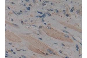 Immunohistochemistry (IHC) image for anti-Mitogen-Activated Protein Kinase 11 (MAPK11) (AA 38-277) antibody (ABIN7439378)
