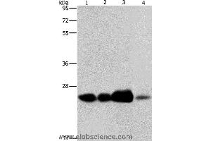 Western blot analysis of 293T cell and human fetal liver tissue, human cervical cancer and fetal muscle tissue, using ARFRP1 Polyclonal Antibody at dilution of 1:800 (ARFRP1 抗体)