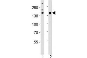 Western blot analysis of lysate from 1) HeLa cell line and 2) mouse cerebellum tissue using Kdm6b antibody at 1:1000. (Kdm6b 抗体  (AA 1023-1057))