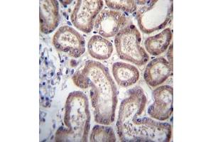 Formalin fixed, paraffin embedded human kidney tissue stained with SP140 Antibody   followed by peroxidase conjugation of the secondary antibody and DAB staining. (SP140 抗体  (Middle Region))