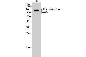 Western Blotting (WB) image for anti-Phosphoinositide 3 Kinase, p85 alpha (PI3K p85a) (pTyr607) antibody (ABIN3182646) (PIK3R1 抗体  (pTyr607))