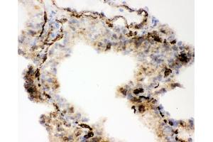 IHC analysis of ACE using anti-ACE antibody (ABIN3043777). (Angiotensin I Converting Enzyme 1 抗体  (AA 651-864))