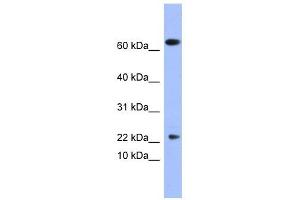 PLA2G5 antibody used at 1 ug/ml to detect target protein. (PLA2G5 抗体  (N-Term))