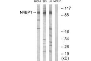 Western Blotting (WB) image for anti-NEDD4 Binding Protein 1 (N4BP1) (AA 383-432) antibody (ABIN2890450) (N4BP1 抗体  (AA 383-432))