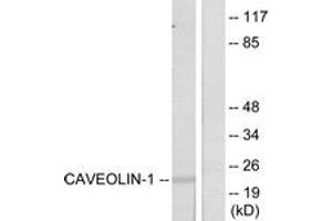 Western Blotting (WB) image for anti-Caveolin 1, Caveolae Protein, 22kDa (CAV1) (AA 5-54) antibody (ABIN2888960) (Caveolin-1 抗体  (AA 5-54))
