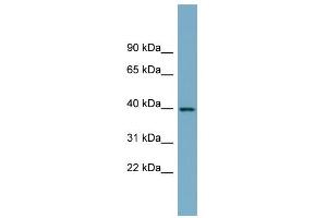 WB Suggested Anti-SULT2B1 Antibody Titration:  0. (SULT2B1 抗体  (N-Term))