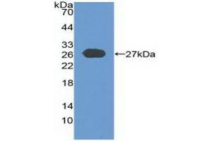 Detection of Recombinant CYLD, Human using Polyclonal Antibody to Cylindromatosis (CYLD) (CYLD 抗体  (AA 170-338))