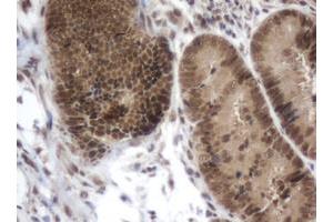 Image no. 1 for anti-Zinc Finger, Imprinted 2 (ZIM2) (AA 1-150), (AA 428-527) antibody (ABIN1490591) (ZIM2 抗体  (AA 1-150, AA 428-527))