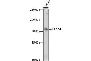 Western blot analysis of extracts of MCF7 cells, using  antibody (ABIN7265738) at 1:1000 dilution.