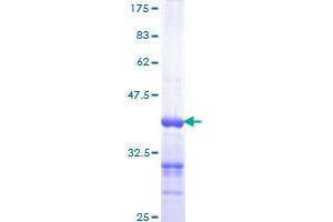 Image no. 1 for HRas proto-oncogene, GTPase (HRAS) (AA 80-179) protein (GST tag) (ABIN1307058) (HRAS Protein (AA 80-179) (GST tag))