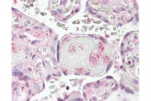 Anti-LYN antibody IHC of human placenta. (LYN 抗体  (AA 39-58))