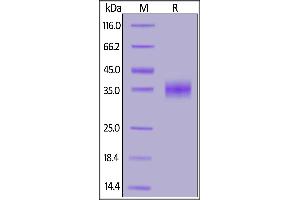 SARS S protein RBD, His Tag on SDS-PAGE under reducing (R) condition. (SARS-CoV Spike Protein (RBD) (His tag))