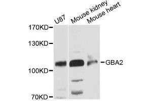 Western blot analysis of extracts of various cell lines, using GBA2 antibody (ABIN6292695) at 1:3000 dilution. (GBA2 抗体)