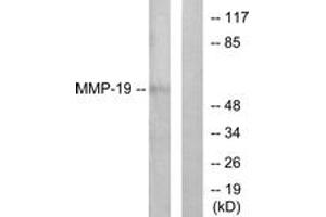 Western blot analysis of extracts from HuvEc cells, using MMP-19 Antibody. (MMP19 抗体  (AA 11-60))