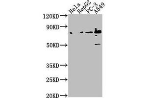 Western Blot Positive WB detected in: Hela whole cell lysate, HepG2 whole cell lysate, PC-3 whole cell lysate, A549 whole cell lysate All lanes: TNS4 antibody at 1:1000 Secondary Goat polyclonal to rabbit IgG at 1/50000 dilution Predicted band size: 77 kDa Observed band size: 77 kDa (Tensin 4 抗体  (AA 20-231))