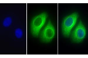 Detection of TUBb in Human Hela cell using Polyclonal Antibody to Tubulin Beta (TUBb) (TUBB 抗体  (AA 170-419))
