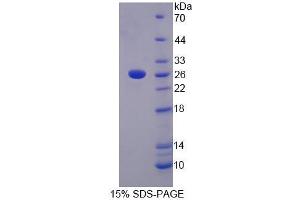 SDS-PAGE analysis of Human LRP3 Protein. (LRP3 蛋白)