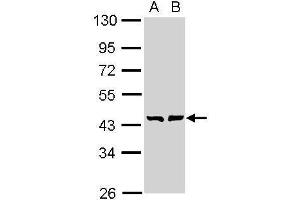 WB Image Sample (30 ug of whole cell lysate) A: A431 , B: H1299 10% SDS PAGE antibody diluted at 1:1000 (GMDS 抗体)