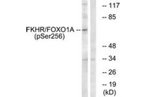 Western blot analysis of extracts from HeLa cells treated with EGF+Serum, using FKHR (Phospho-Ser256) Antibody. (FOXO1 抗体  (pSer256))
