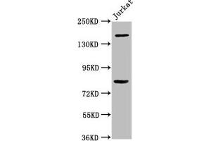 Western Blot Positive WB detected in: Jurkat whole cell lysate All lanes: BCL9 antibody at 3. (BCL9 抗体  (AA 231-340))