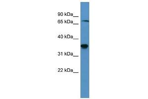Western Blot showing SH3BP5 antibody used at a concentration of 1-2 ug/ml to detect its target protein. (SH3BP5 抗体  (C-Term))