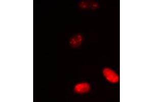 Immunofluorescent analysis of Histone H3 (AcK18) staining in HeLa cells. (Histone 3 抗体  (H3K18ac))