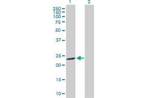 Western Blot analysis of GSTM4 expression in transfected 293T cell line by GSTM4 MaxPab polyclonal antibody. (GSTM4 抗体  (AA 1-218))