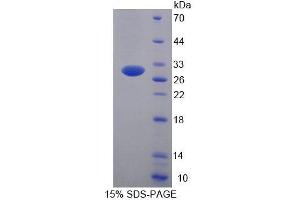 SDS-PAGE analysis of Human UBE2S Protein. (UBE2S 蛋白)