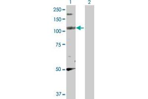 Western Blot analysis of PPFIBP2 expression in transfected 293T cell line by PPFIBP2 MaxPab polyclonal antibody. (PPFIBP2 抗体  (AA 1-876))