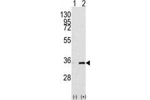 Western blot analysis of PHB2 (arrow) using rabbit polyclonal PHB2 Antibody . (Prohibitin 2 抗体  (Tyr128))