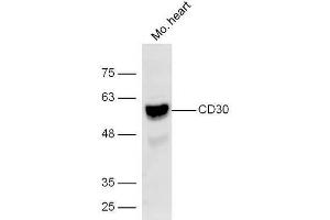 Lane 1: Mouse heart lysates probed with Rabbit Anti-CD30 Polyclonal Antibody, Unconjugated (ABIN1385704) at 1:300 overnight at 4˚C. (TNFRSF8 抗体  (AA 51-150))