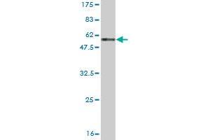 Western Blotting (WB) image for anti-Carbonic Anhydrase I (CA1) (AA 1-261) antibody (ABIN560129)