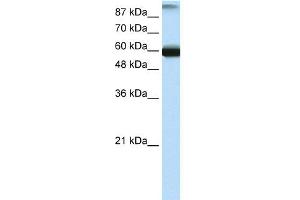 WB Suggested Anti-GTF3C5 Antibody Titration:  0. (GTF3C5 抗体  (N-Term))