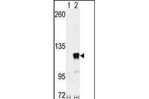 Western blot analysis of PUM2 (arrow) using PUM2 Antibody  (ABIN392131 and ABIN2841870). (PUM2 抗体  (AA 159-189))