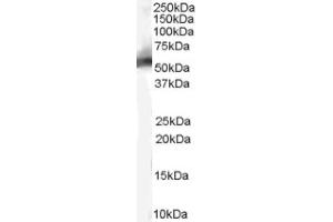 Image no. 1 for anti-Mdm2, p53 E3 Ubiquitin Protein Ligase Homolog (Mouse) (MDM2) (Internal Region) antibody (ABIN374627) (MDM2 抗体  (Internal Region))