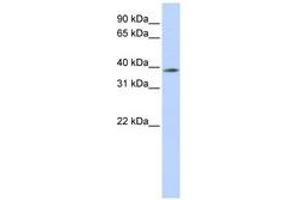 Image no. 1 for anti-Methyl-CpG Binding Domain Protein 2 (MBD2) (N-Term) antibody (ABIN6742279) (MBD2 抗体  (N-Term))