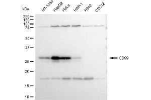 Western blotting analysis using CD99 antibody (ABIN7797990). (Recombinant CD99 抗体)