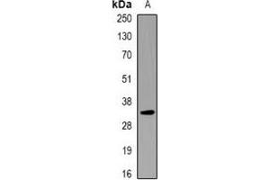 Western blot analysis of KCNE1 expression in RAW264. (KCNE1 抗体)