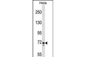 GALNT6 Antibody (C-term) (ABIN1537465 and ABIN2848506) western blot analysis in Hela cell line lysates (35 μg/lane). (GALNT6 抗体  (C-Term))