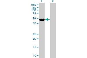 Western Blot analysis of OSMR expression in transfected 293T cell line by OSMR MaxPab polyclonal antibody. (Oncostatin M Receptor 抗体  (AA 1-342))