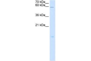 Western Blotting (WB) image for anti-Retinoic Acid Receptor Responder (Tazarotene Induced) 3 (RARRES3) antibody (ABIN2462984)