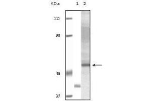 Western blot analysis using Akt3 mouse mAb against truncated Akt3 recombinant protein (1) and human ovary carcinoma tissue lysate (2). (AKT3 抗体)