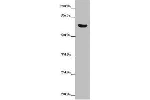 Western blot All lanes: CERKL antibody at 14 μg/mL + Mouse lung tissue Secondary Goat polyclonal to rabbit IgG at 1/10000 dilution Predicted band size: 63, 60, 53, 48, 43, 25, 20, 58 kDa Observed band size: 63 kDa (CERKL 抗体  (AA 1-558))