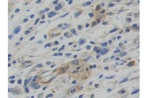 Immunohistochemistry (IHC) image for anti-Tryptophanyl-tRNA Synthetase (WARS) (AA 247-458) antibody (ABIN7441784)